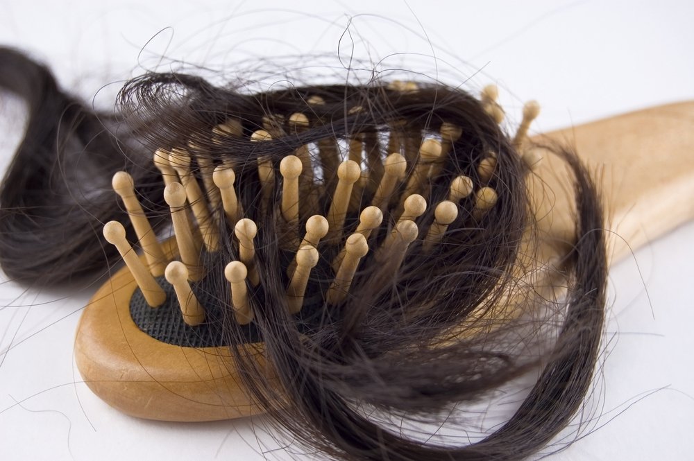 Випадає волосся, що робити? Лікування, профілактика та народні поради