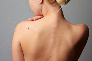 Значення родимок на спині (попереку, хребті) для чоловіків і жінок – що такий знак може сказати про людину