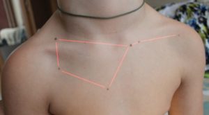 Значення фігур з родимок на тілі людини – знаки долі з родимих плям у вигляді трикутника, ромба, сузіря та інших