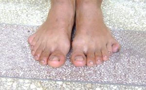 Що означає, якщо свербить одна або обидві ноги – народні прикмети та варіанти тлумачень