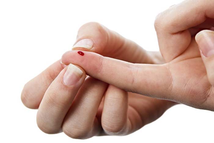 Прикмета: вколоти палець голкою або шпилькою до крові, значення для жінки