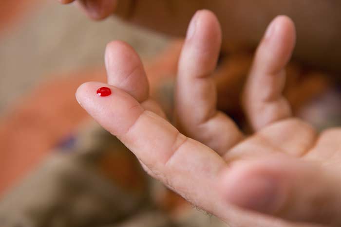 Прикмета: вколоти палець голкою або шпилькою до крові, значення для жінки