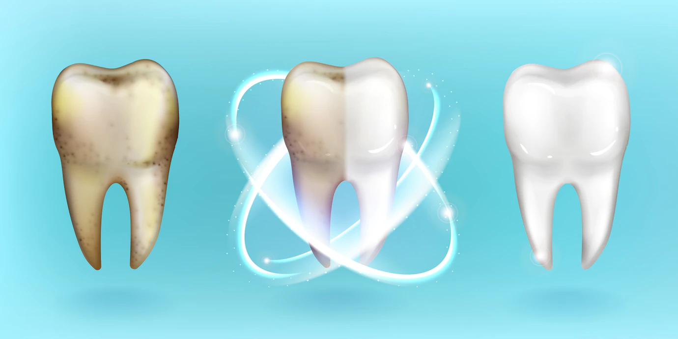 Гігієна ротової порожнини, стоматологи гігієністи і як позбудеться проблем з чутливістю зубів!