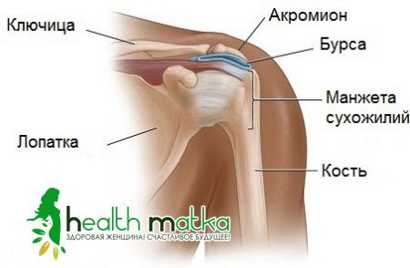 Бурсит плечового суглоба: клінічні прояви та лікування