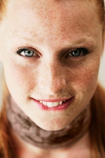 Пігментні плями на обличчі: видалення і профілактика