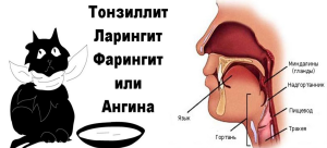 Що викликає біль у горлі і як її зняти?