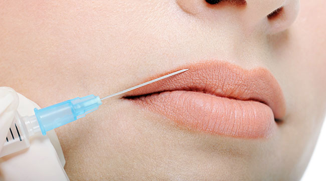 Як збільшити губи гіалуронової кислотою?