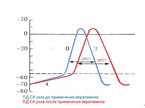 Різні ліки від аритмії серця – класифікація та вибір препарату від аритмії Різні ліки від аритмії серця – класифікація та вибір препарату від аритмії