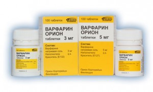 Тромбоз глибоких вен нижніх кінцівок: симптоми на фото і лікування Тромбоз глибоких вен нижніх кінцівок: симптоми на фото і лікування