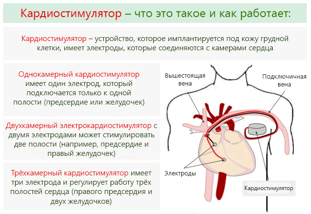 Брадикардія серця, що це таке, чи небезпечна вона для здоровя?